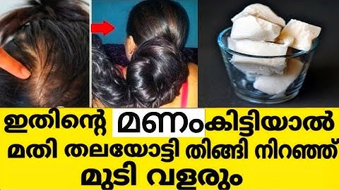 ഒരൊറ്റ യൂസിൽ മുടിയുടെ ഉള്ളു വർദ്ധിപ്പിക്കാനും തലയോട്ടി തിങ്ങിനിറഞ്ഞു മുടിവളരാനും ഒരു Hair Tonic🥛