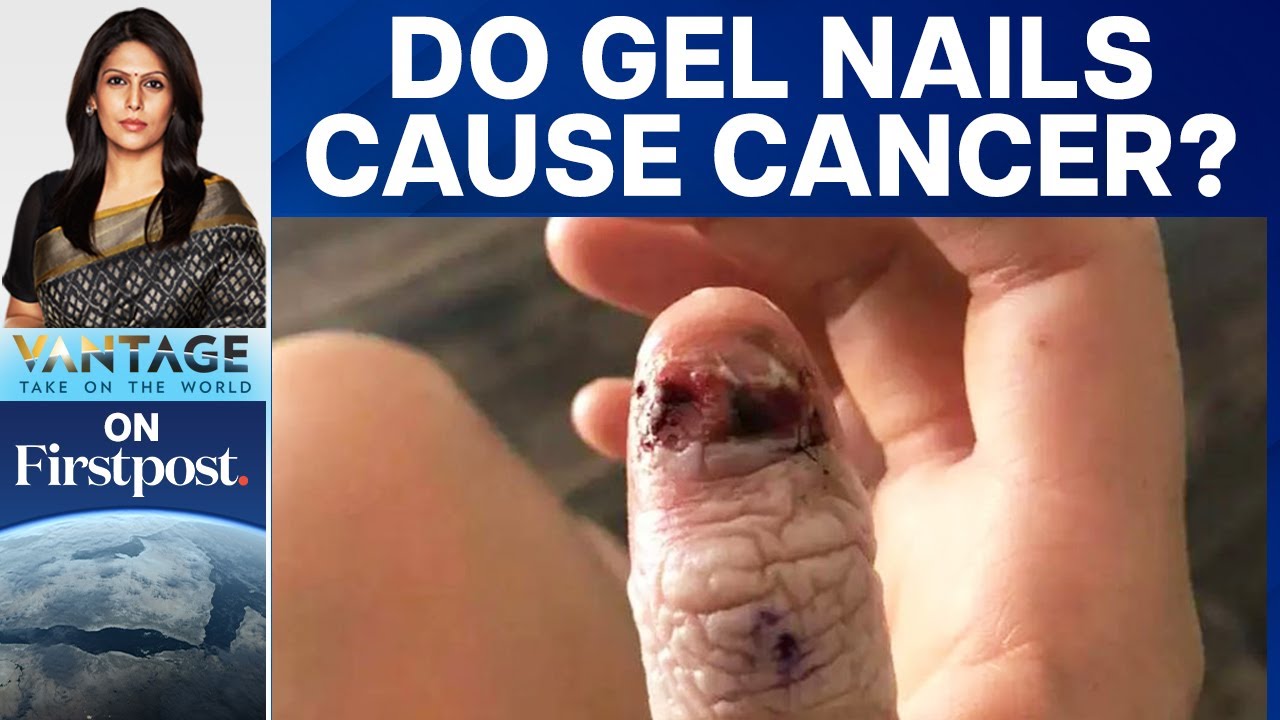 Woman Loses Thumb to Skin Cancer Caused by Nail Biting | Allure