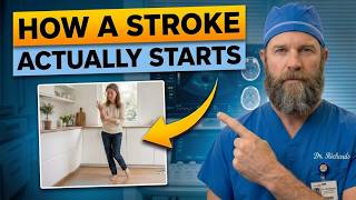 This Is How a Stroke Starts: 5 Common Warning Signs You Ignore Every Day