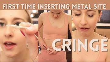INSERTING A METAL INSULIN PUMP SITE FOR THE FIRST TIME | t:slim X2 TruSteel