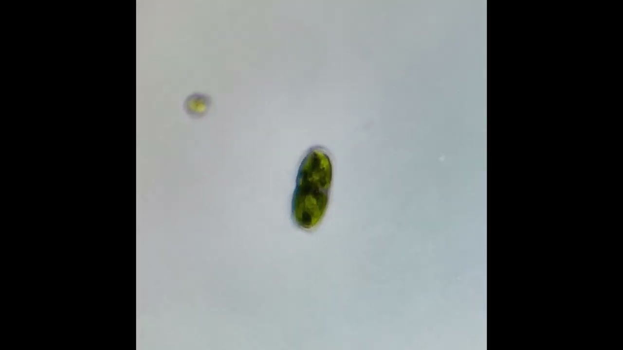 Cylindrocystis brebissonii