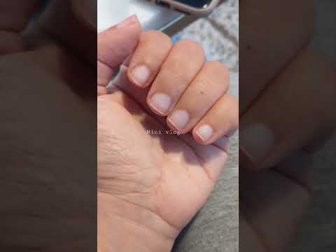  جل الأضافر        