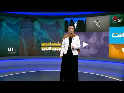 وفاة طفلة يمنية جوعاً في مخيم للنازحين بحجة