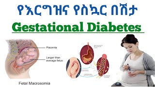 የእርግዝና የስኳር በሽታ ፣ ምልክቶች፣ መንስኤዎች እና ህክምናው | Gestational diabetes ,cause ,sign and treatment