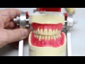 How Dentures Are Made