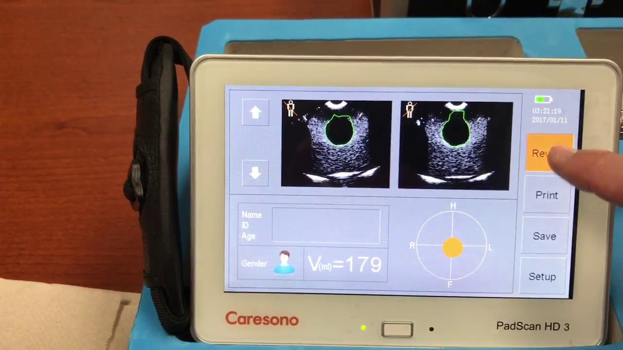 Tranquility II Multiparameter Patient Monitor 12.1in Touchscreen