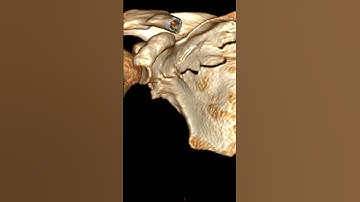 CT Scans Peeking Inside the Body #medical #medicaltechnology #healthcareeducation #medicalequipment
