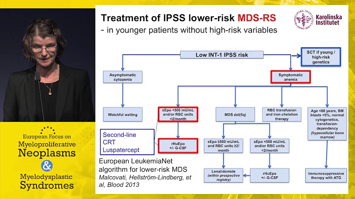 My approach to MDS management