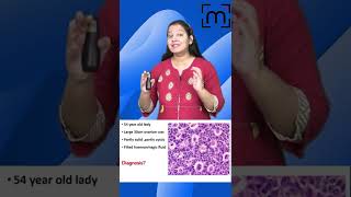 Try To Answer This (Clinical Case 6) | MedLive | Dr. Priyanka Sachdev