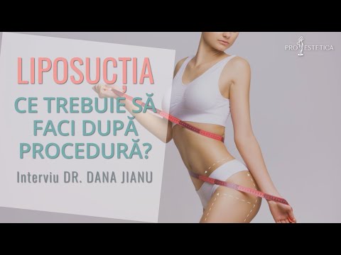 Ce trebuie să faci după procedura de #liposuctie?Contraindicații intervenție | 🥇Clinica ProEstetica