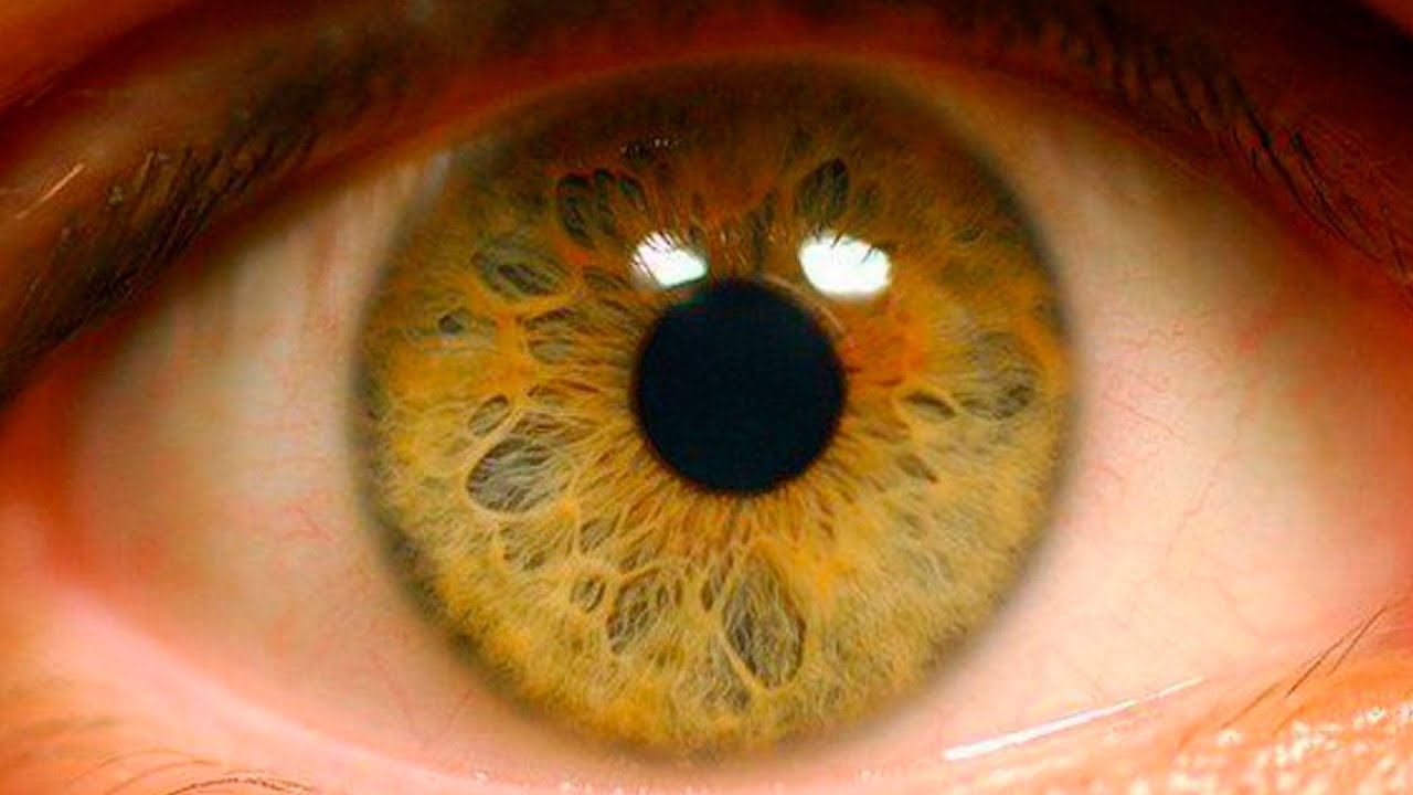 Можно ли восстановить зрение при минус 4, при усталости и напряжении глаз