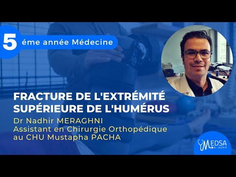 Fracture de l&rsquo;extrémité supérieure de l&rsquo;humérus | Dr Nadhir MERAGHNI