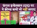 Ringworm Fungal Infection Treatment In Hindi | Fungal Infection Cream Without Steroids | Dr Sunil