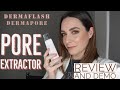 Dermaflash | Dermapore | Pore Extractor | Sonic Blackhead Removing Device | Review | Demo