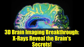 3D Brain Imaging Breakthrough: X-Rays Reveal the Brain