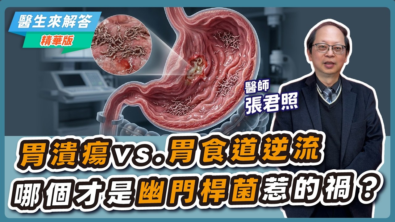【愛健康│醫生來解答】胃潰瘍 vs. 胃食道逆流 哪個才是幽門桿菌惹的禍？