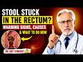 Stool STUCK in the Rectum? Warning Signs, Causes & What to Do Now | Doctor Explains