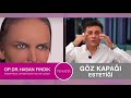 Göz kapağı Estetiği