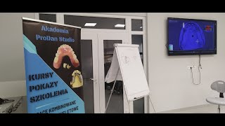 Cyfrowy workflow protez szkieletowych | Exocad Partialcad | Druk 3D | Spiek 3D | Szkolenie BCU Łódź