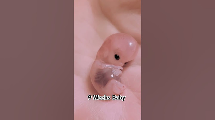 9 Weeks Baby #viralshortfeed #baby #pregnant