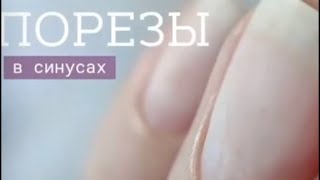 Порезы в синусах / работа фрезой пламя ?/ аппаратный маникюр/ новичок