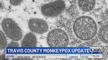 What you need to know about monkeypox symptoms, how its spread