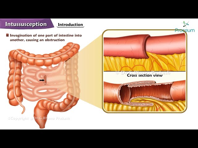 Балмұздақ жеу кезінде жыныстық қатынас