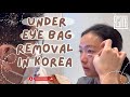 Under eyebag removal in korea  seoul guide medical