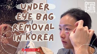 Under Eyebag Removal In Korea Seoul Guide Medical