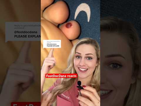Doctor reacts: popping