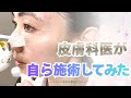 【肌再生医療】自分の顔で実験します。ドクターセルフ施術の全工程【美容】