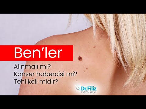 Cildimizdeki benler neyin habercisi? Dr. Filiz Erdem Bayram