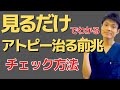 【アトピー 治る前兆】アトピー性皮膚炎いつ治るのか把握する方法！治る過程を知ってください！