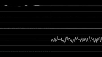 VLDC9- Abstract Map "improved" {0scilloscope view}