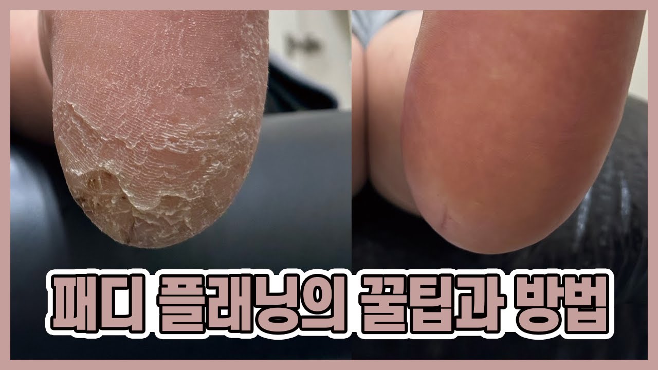 발 각질을 제거해 깨끗한 발로 만들어주는 패디 플래닝