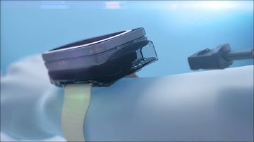 ViSi Mobile   CGI Animation with Voiceover