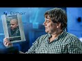 8 Years Later: John’s Hair Transplant Journey!