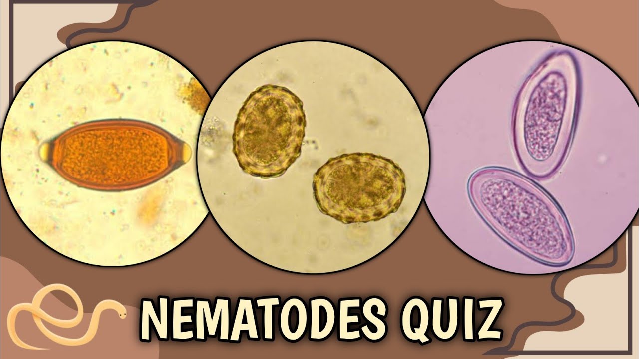 Parasitology Quiz #1 | Nematodes