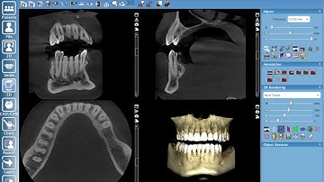 Romexis 5X and 4X Setup with Tips and Tricks