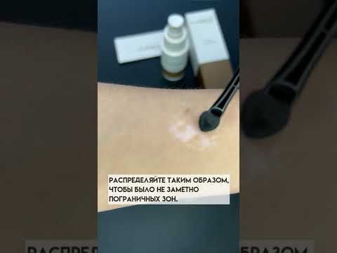 Видео: 3 способа скрыть пятна от витилиго с помощью макияжа