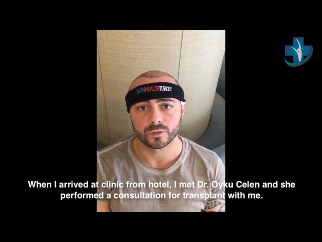 Hair Transplantation Turkey - Mr. Domenico G. Testimonial - Skin Health Turkey / Dr. Oyku Celen