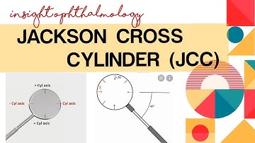 JACKSON CROSS CYLINDER || JCC || TESTING & TECHNIQUE WITH EXAMPLES || REFRACTION SERIES||