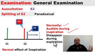 Clinical Cardiology (15) #internal_medicine #cme #medicaleducation #ecg #محاضرات_باطنة #medical screenshot 1