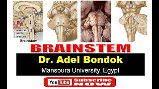 Brainstem, Dr Adel Bondok