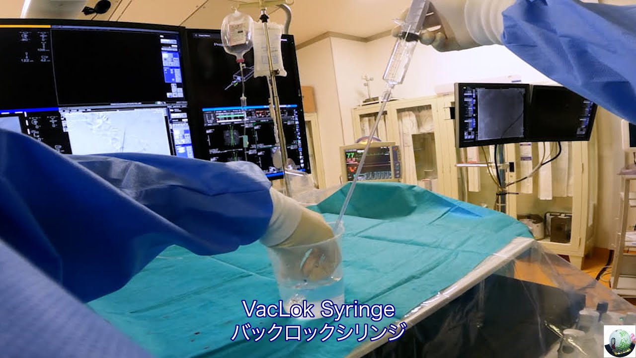 Vacloc VacLok Syringe バックロックシリンジ - YouTube