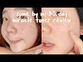 SOME BY MI 30 DAY MIRACLE TONER PROGRESS REVIEW (Philippines)