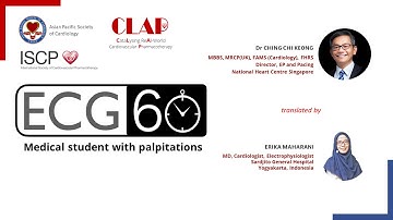 ECG in 60s - Medical student with palpitations (Indonesian)