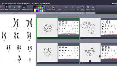 CytoCloud - Gallery View