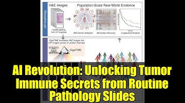 AI Revolution: Unlocking Tumor Immune Secrets from Routine Pathology Slides