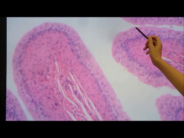 Tecido Epitelial 2 Epitelio De Revestimento Laminas Youtube